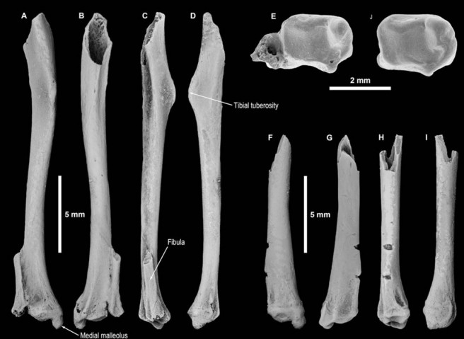 Tibiae. A–E, right tibia; A, anterior view; B, posterior view, C, lateral view; D, medial view; E, distal view. F–J, right tibia; F, anterior view; G, posterior view; lateral view; I, medial view; J, distal view