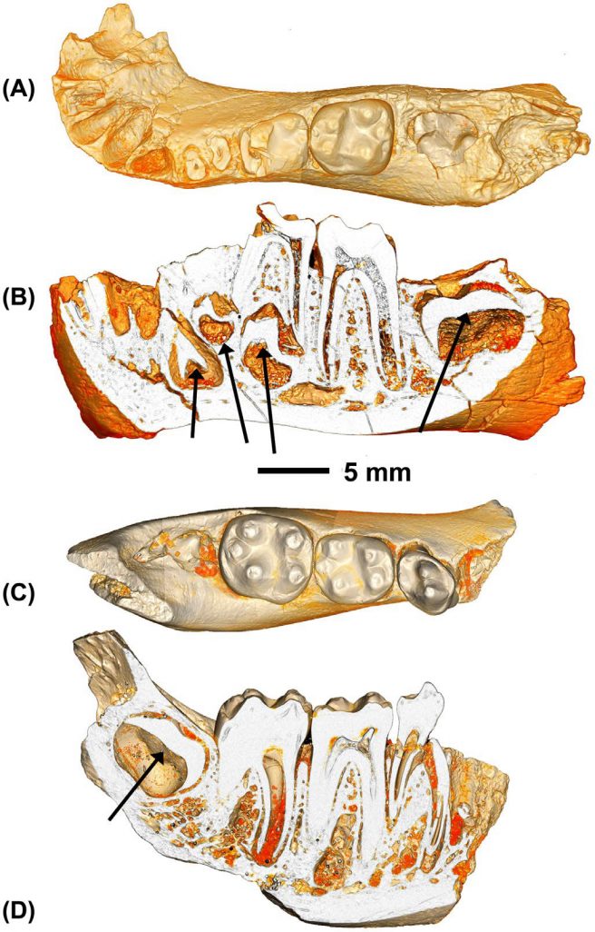 Juvenile Aegyptopithecus zeuxis from Fayum Quarry I. DPC 9866, left dentary dp4-m1fully erupted, m2 in crypt near alveolar margin, in occlusal (A) and lateral cutaway (B) views, arrows in B indicate positions of permanent canine, p3-4, and m2 embedded in the mandible. DPC 13599, right dentary p4-m2, m3 in crypt near alveolar margin, in occlusal (C) and lateral cutaway (D) views, arrow in D indicates m3 enamel cap still entombed in mandible while p4 is fully erupted.